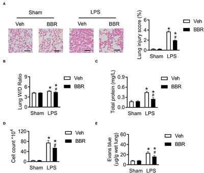 Berberine Ameliorates Inflammation in Acute Lung Injury via NF-κB/Nlrp3 Signaling Pathway